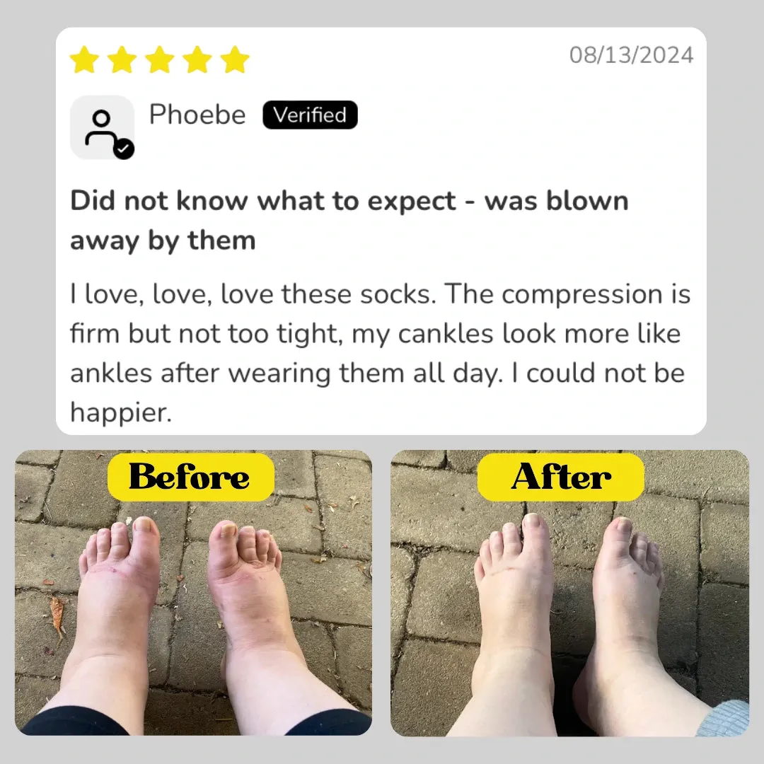 Classic Black Dots Compression Socks